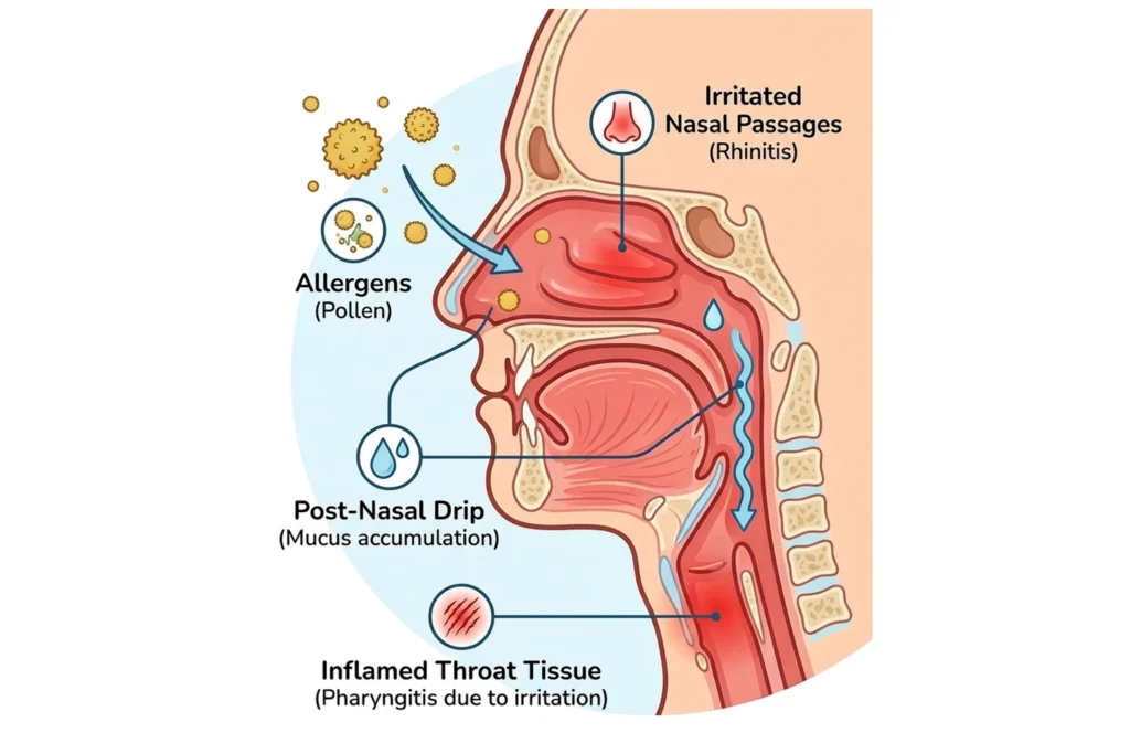 Hayfever and Sore Throat Connection